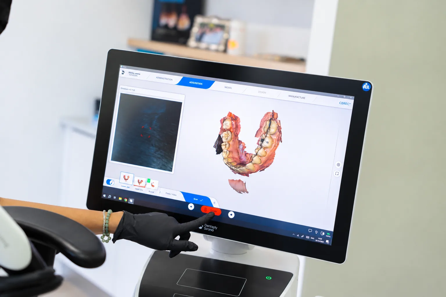 A 3D scan of the teeth on the planning screen